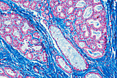Lactating breast tissue, light micrograph