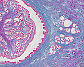 Prostate gland and urethra, light micrograph