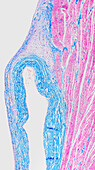 Pulmonary valve, light micrograph