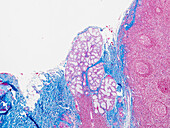 Tonsil and salivary gland, light micrograph