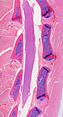 Foetal spine, light micrograph