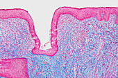 Tongue, light micrograph