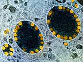 SARS-CoV-2 infecting olfactory epithelial cells, TEM
