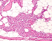 Adult parathyroid gland, light micrograph