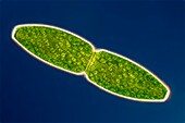 Pleurotaenium sp. green algae, light micrograph