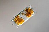 Biddulphia diatom, light micrograph