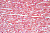 Human cardiac muscle, light micrograph