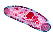 Liver fluke, light micrograph
