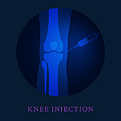 Knee joint injection treatment, conceptual illustration