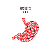 Gastritis awareness, conceptual illustration