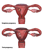 Singleton and multiple pregnancy, illustration