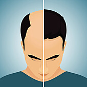 Hair loss in men, conceptual illustration