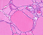 Human thyroid gland follicles, light micrograph