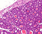 Thyroid gland capsule, light micrograph