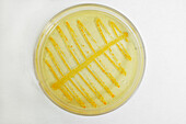 E. coli sample