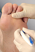 Podiatrist performs a foot sensitivity test on her patient