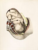 Childbirth, 19th century illustration