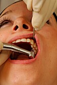 Dental treatment