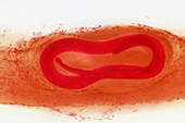 Trichinella roundworm, LM