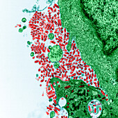 Rabies virus, TEM