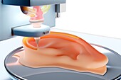 3D printing of an ear prosthesis, illustration