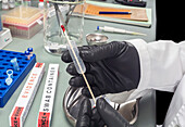 Extracting blood sample for forensic analysis