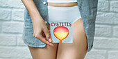 Cystitis, conceptual image
