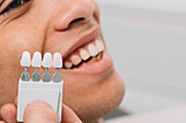 Teeth whitening sample colours