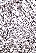 Human adrenal gland cortex, light micrograph