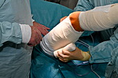 Bandaging of patient's leg after excision of skin cancer
