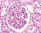 Kidney corpuscle, light micrograph