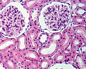 Kidney parenchyma, light micrograph