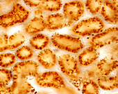 Peroxisomes in kidney convoluted tubule, light micrograph