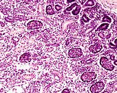 Human foetal kidney corpuscle development, light micrograph