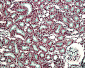 Kidney stained with Massonâ??s trichrome, light micrograph