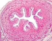 Ureter, light micrograph