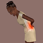 Woman with lower back pain, illustration