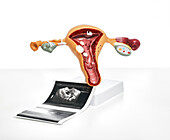 Female reproductive disorders, conceptual image
