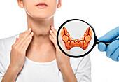 Thyroid disease, conceptual image
