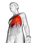 Elderly man's lungs, illustration