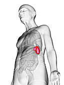 Elderly man's spleen, illustration