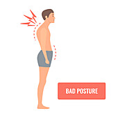 Bad posture, conceptual illustration
