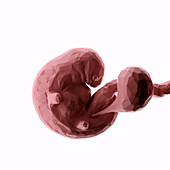 Human fetus at week 6, abstract illustration