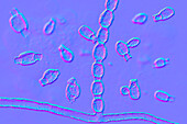 Coccidioidomycosis fungus, illustration