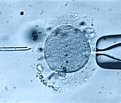 In vitro fertilisation, light micrograph