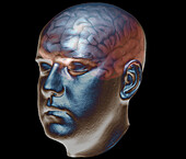 Normal brain, 3D CT scan