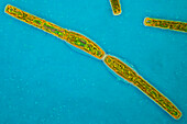 Pleurotaenium ehrenbergii algae, light micrograph