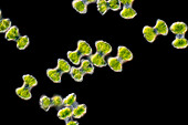 Staurastrum margaritaceum algae, light micrograph