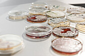 Environmental fungi growing on petri dishes