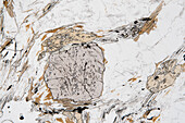 Gneiss with garnet, light micrograph